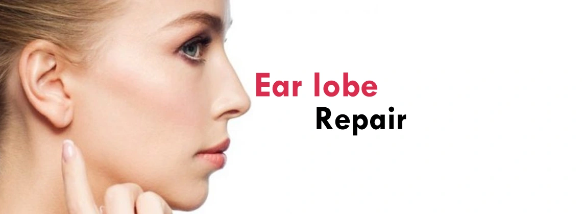 Ear Lobe Correction Clinic in Gurgaon, Delhi NCR